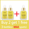 Dark Spots, Lighten Freckles Melasma, Facial Dark Spots