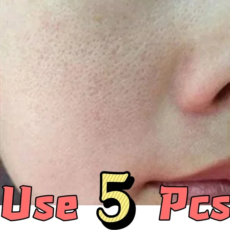 Smooth skin|Shrink pores, facial serum with retinol and niacinamide