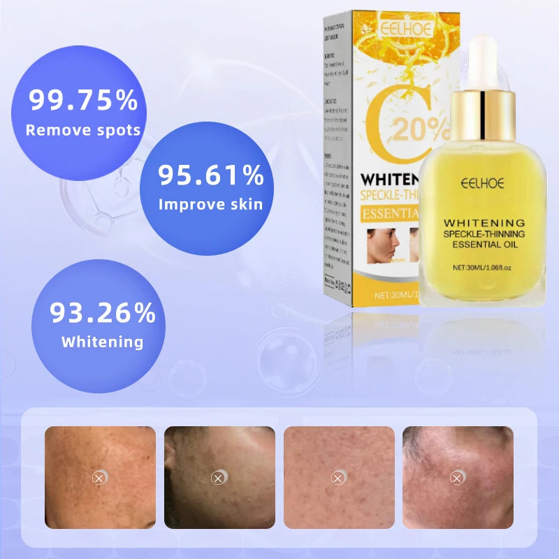 Dark Spots, Lighten Freckles Melasma, Facial Dark Spots