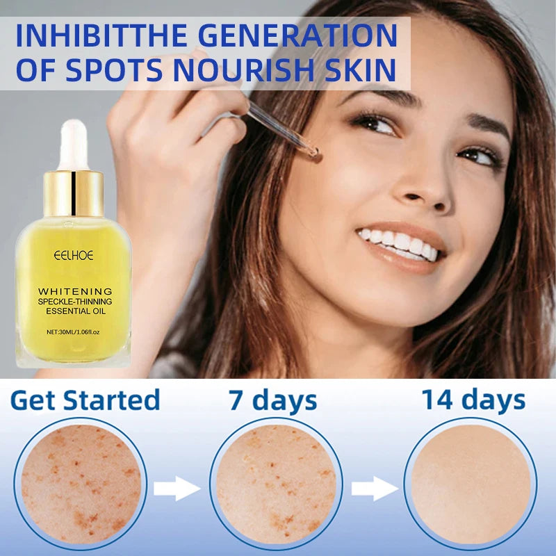 Dark Spots, Lighten Freckles Melasma, Facial Dark Spots