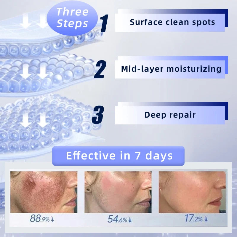 Dark Spots, Lighten Freckles Melasma, Facial Dark Spots
