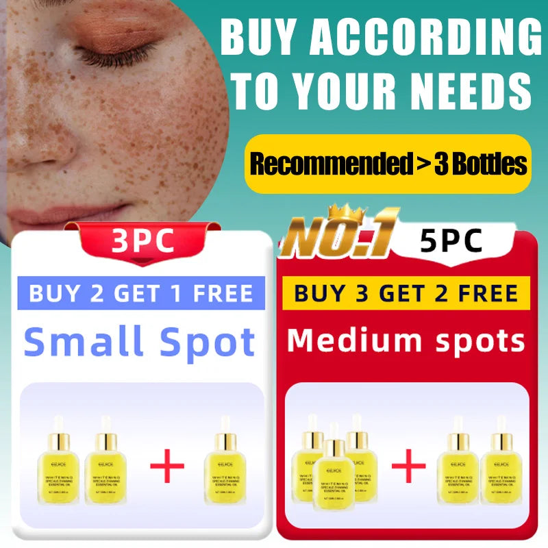 Dark Spots, Lighten Freckles Melasma, Facial Dark Spots