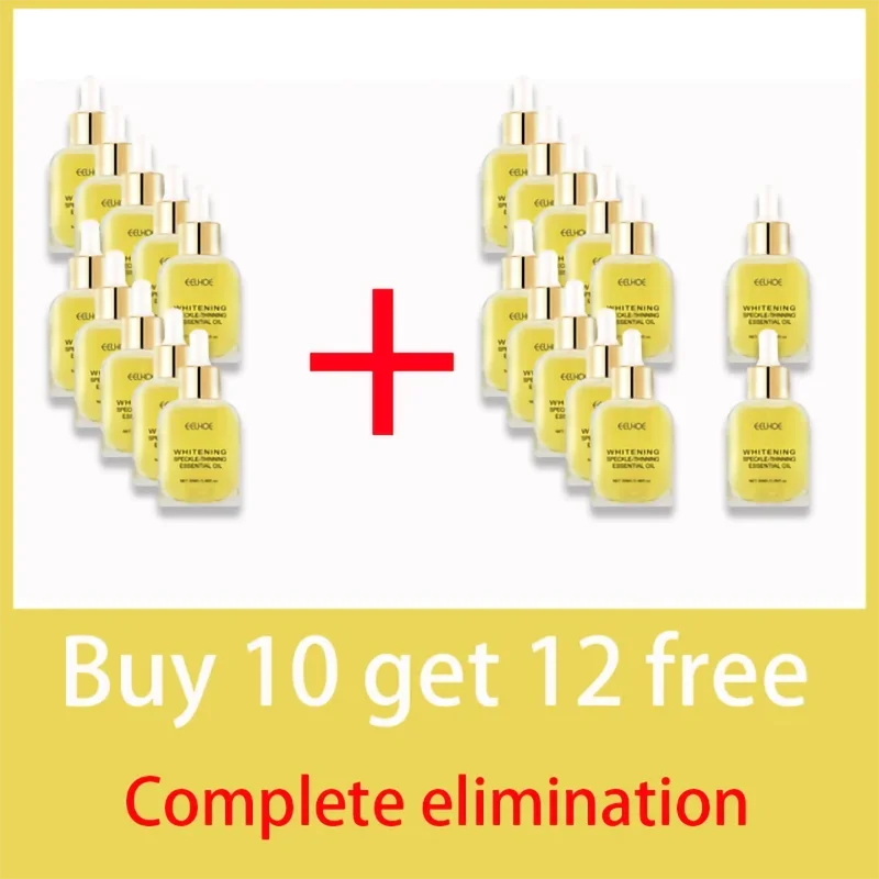 Dark Spots, Lighten Freckles Melasma, Facial Dark Spots
